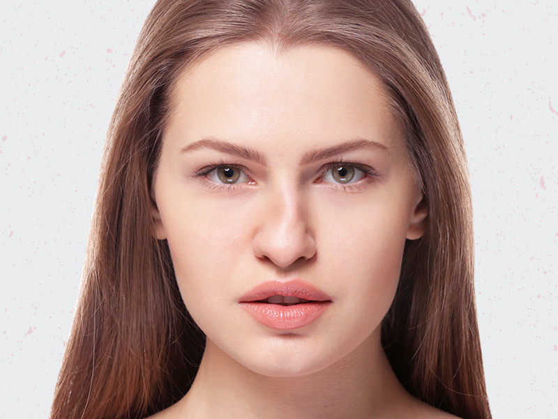 Rinoplastia reparadora ou pós-traumática tipo rinoplastia reparadora