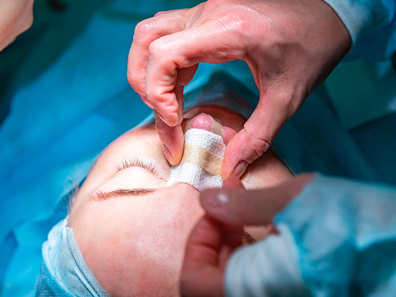 Imagem de um cirurgião plástico colocando o curativo no nariz de uma paciente que passou pela rinoplastia secundária