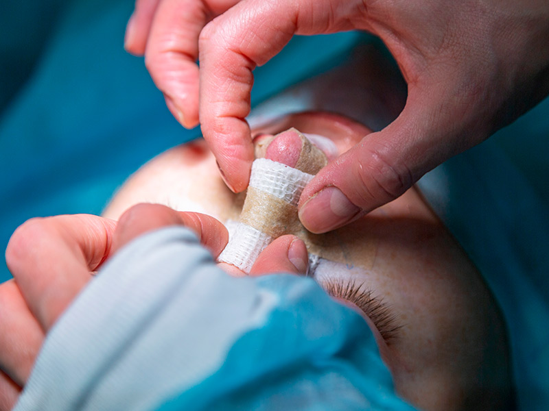 Imagem de um médico realizando a troca de curativos de uma paciente que se submeteu à cirurgia no nariz