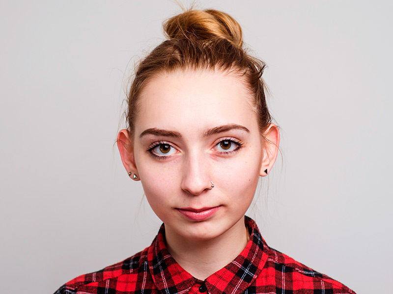 O que é otoplastia? Na imagem aparece uma mulher em primeiro plano e chama a atenção pelo tamanho das orelhas grandes