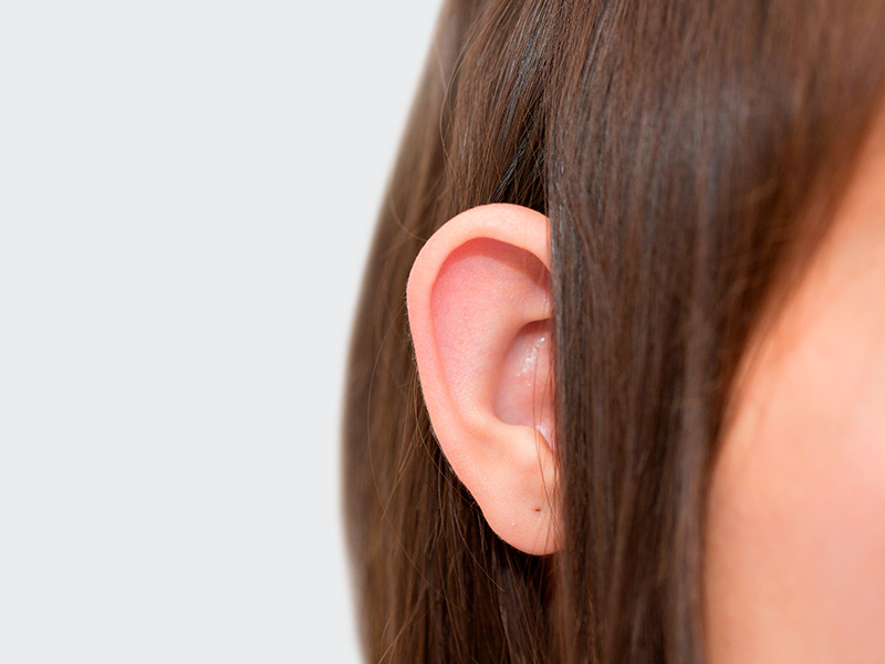 A imagem destaca uma orelha com a técnica earshutt, também conhecida como otoplastia fechada