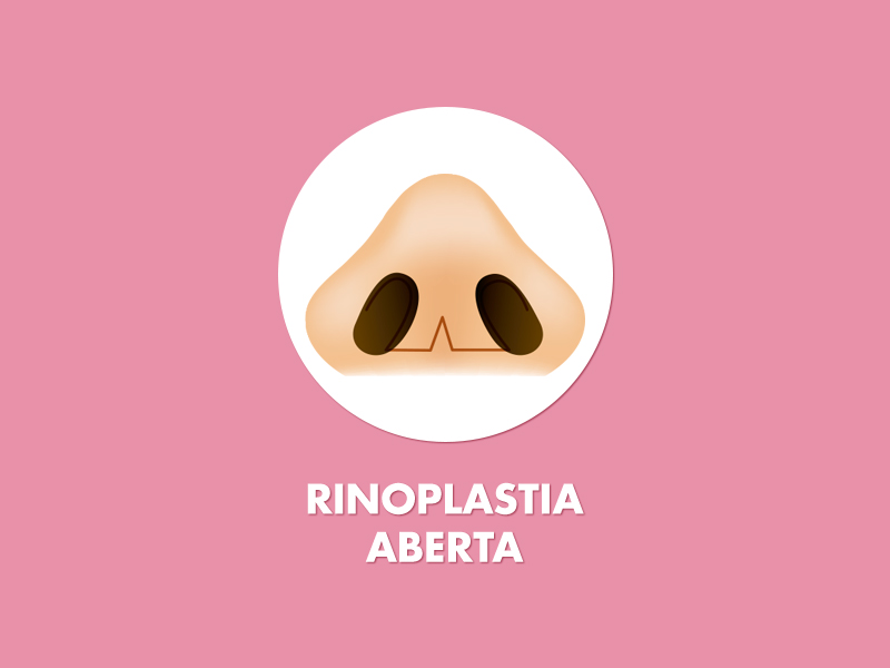 Cicatriz rinoplastia aberta