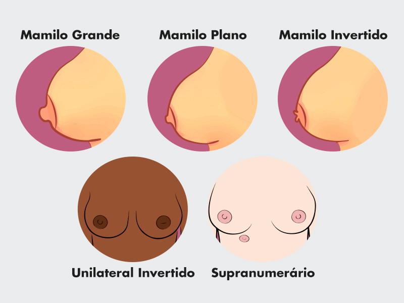 Ilustração com todos os tipos de mamilos 