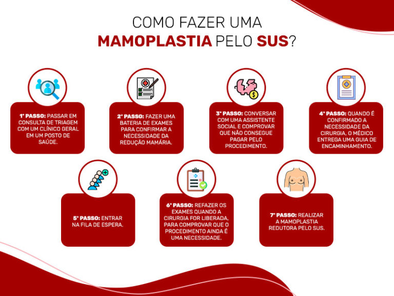 Mastopexia e mamoplastia redutora pelo SUS | Dream Plastic