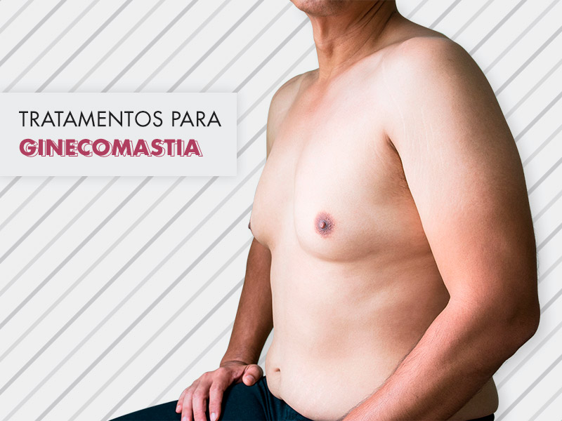 Ginecomastia: tratamento natural com exercícios e dietas funciona? Descubra aqui! ginecomastia tratamento