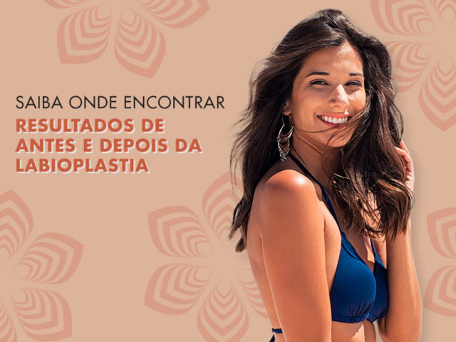 Labioplastia - Antes e depois para conferir | Dream Plastic