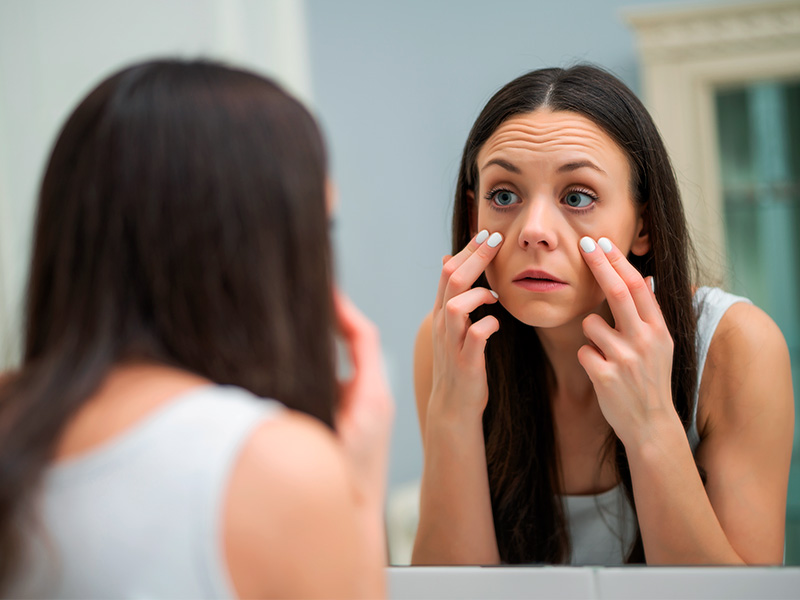 O que causa a Ptose Palpebral? bolsa olhos