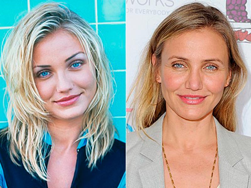 Imagem com o antes e depois da atriz Cameron Diaz após a blefaroplastia