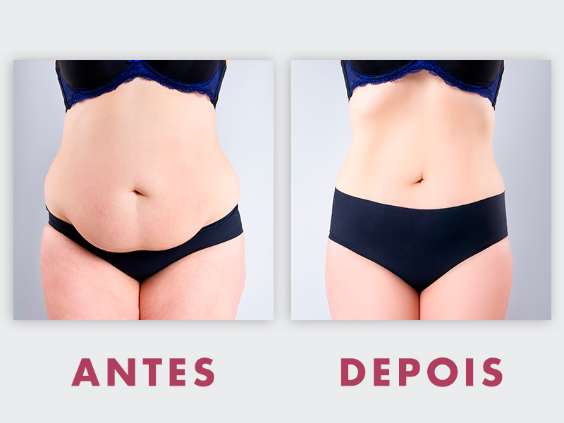 Não confie em resultados publicados pelo próprio médico melhor cirurgiao plastico abdominoplastia
