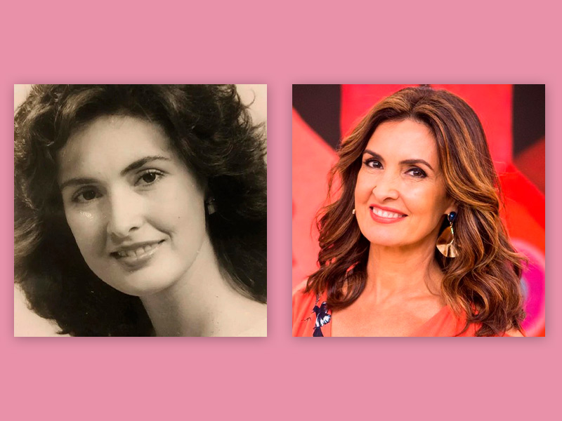 Antes e depois do Botox da Fátima Bernardes botox facial antes depois