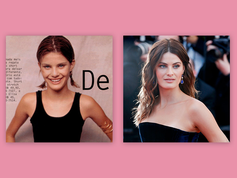 O resultado do Botox de prevenção da Isabeli Fontana fotos botox