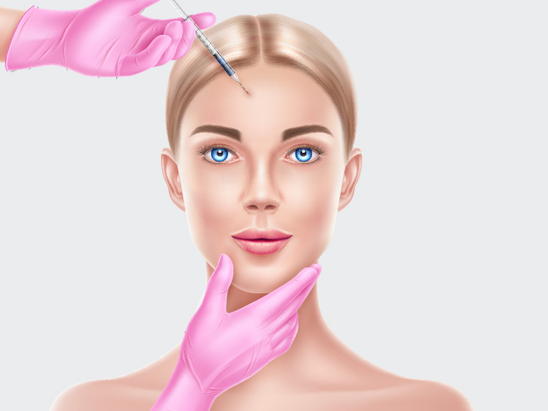 Ilustração de uma mulher realizando a aplicação de botox na testa