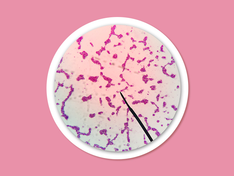 Imagem da toxina botulínica em um microscópio