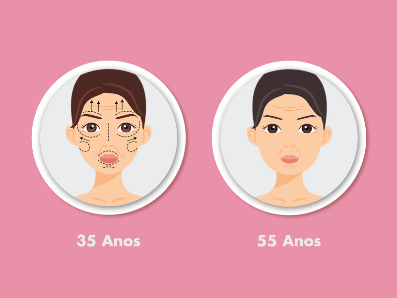 Duas ilustrações de mulher com 35 e 55 anos com botox no rosto