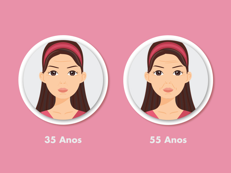 Ilustração do antes e depois do botox no bigode chinês em mulher com 34 e 55 anos
