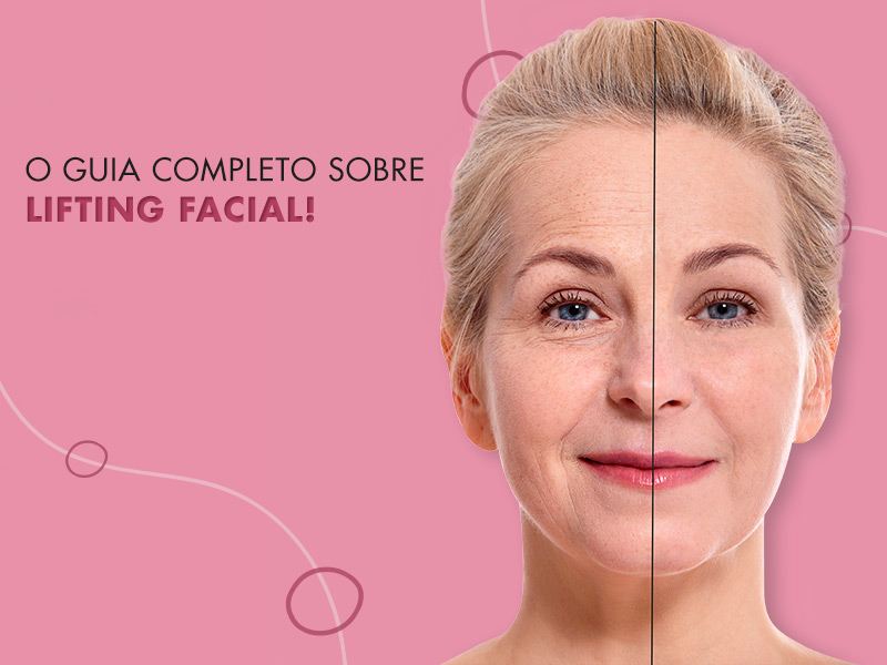 Tudo sobre Lifting Facial! tudo sobre lifting