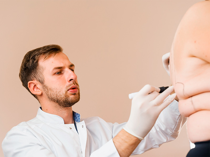 Imagem de um médico realizando as marcações corporais em uma paciente que irá se submeter à cirurgia plástica nas costas