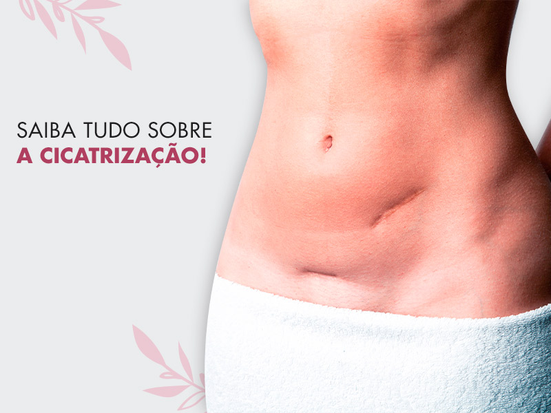 Cicatrização - Como ter uma boa cicatriz | Dream Plastic Cicatrização - Como ter uma boa cicatriz | Dream Plastic