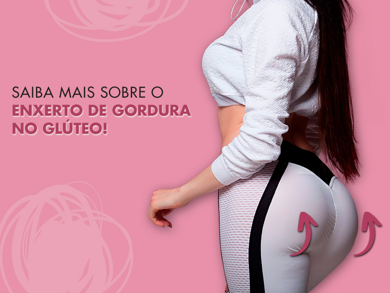 Enxerto de gordura no glúteo: o que é, qual o valor, fotos de antes e depois e depoimentos sobre a técnica! enxerto gordura gluteo