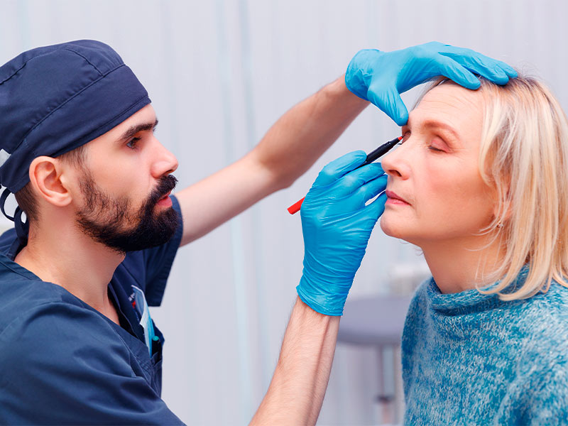 Imagem de um cirurgião plástico realizando as marcações faciais na paciente que irá se submeter ao procedimento de mini lifting 