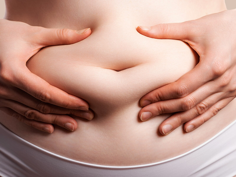 Imagem de uma mulher segurando a gordura localizada na barriga, a famosa pochete