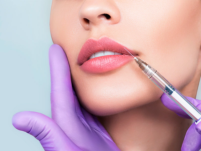 Você tem medo de realizar preenchimento facial? Mão com luvas roxas mostrando como faz preenchimento nos lábios