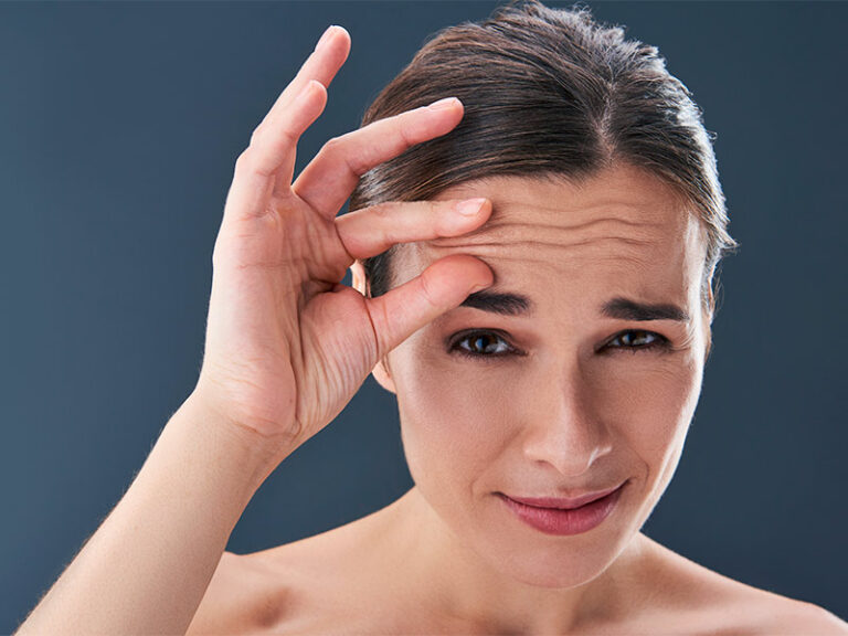Preenchimento De Rugas Na Testa Preço Preenchimento Facial - Veja o antes e depois | Dream Plastic