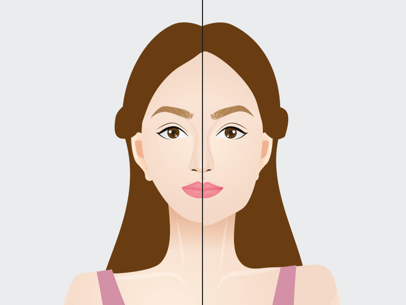 Ilustração mostrando o antes e depois da harmonização facial no rosto de uma mulher.