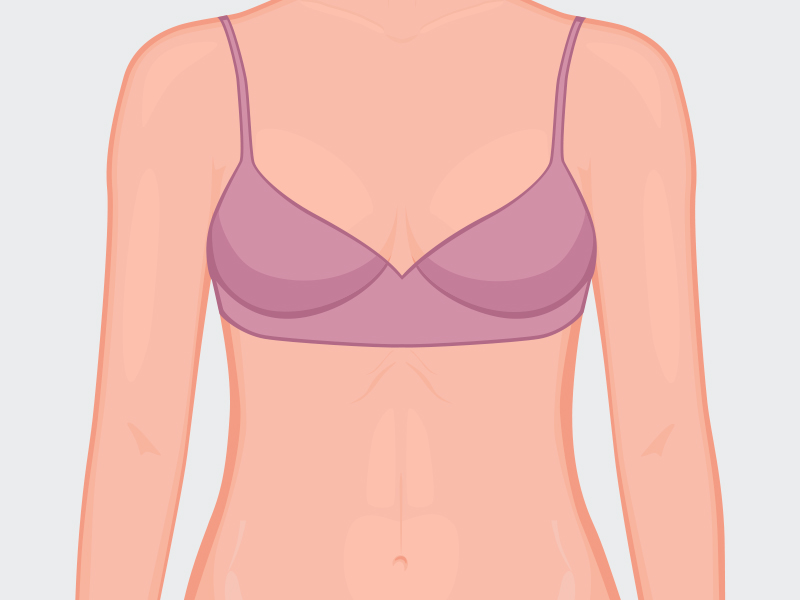 Ilustração de mulher que não pode levantar os braços depois da mamoplastia