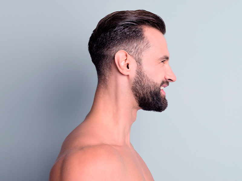 Imagem de um homem de perfil, com o contorno mandibular bem definido