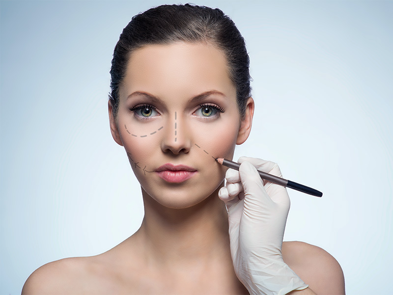 Imagem de uma mulher recebendo marcações faciais para cirurgia plástica que irá harmonizar o rosto