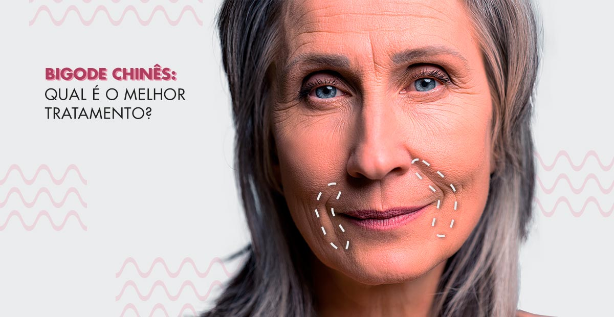 Bigode Chinês: o que fazer para prevenir e como tratar?