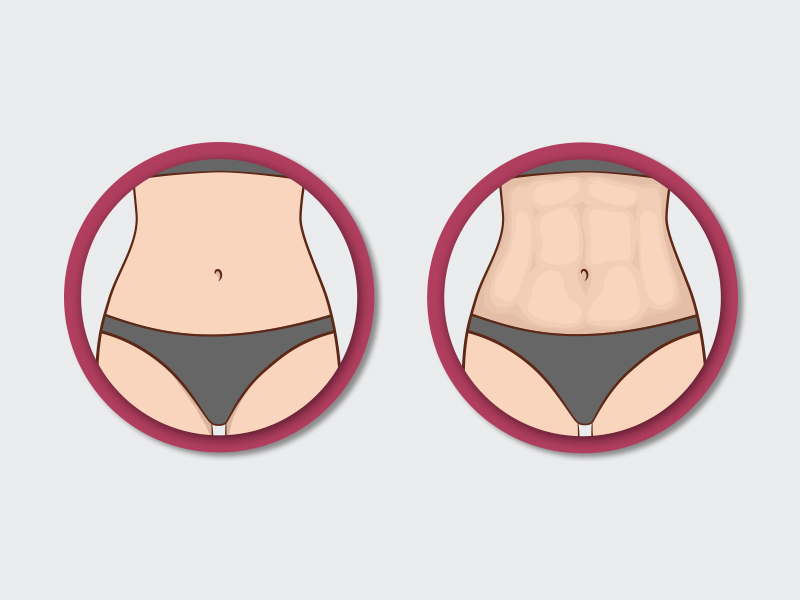 Como é o antes e depois do renuvion? antes depois renuvion