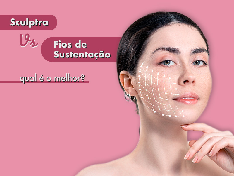 Imagem do rosto de uma mulher com os seguintes dizeres ao lado: sculptra ou fios de sustentação, qual é o melhor?