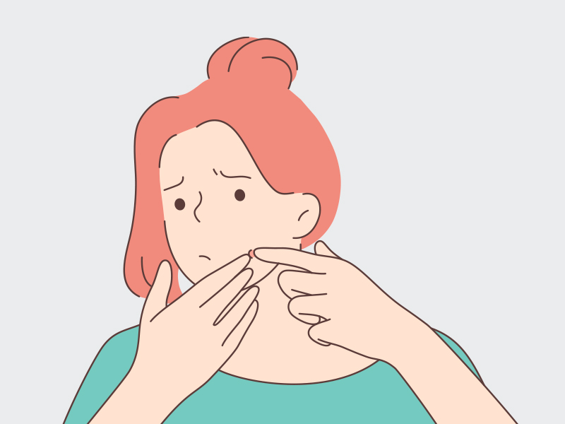 Ilustração de uma menina estourando um cisto epidérmico na bochecha