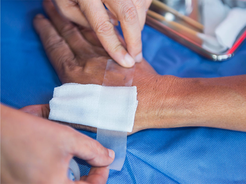 Mãos fazendo um curativo na mão para a recuperação da cirurgia do cisto epidérmico 