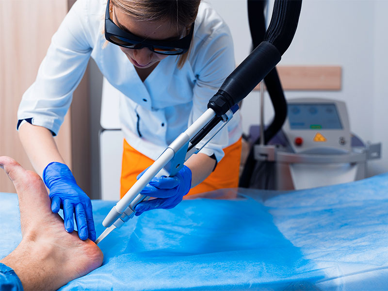 Imagem de um paciente com verruga no pé e uma profissional realizando a cirurgia a laser para a retirada
