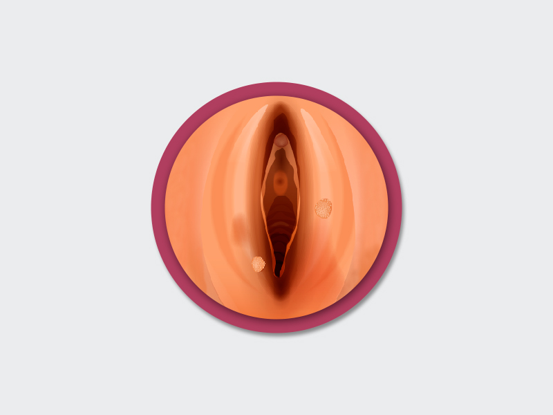 Recomendações para a verruga na vagina Ilustração de uma vagina com verrugas