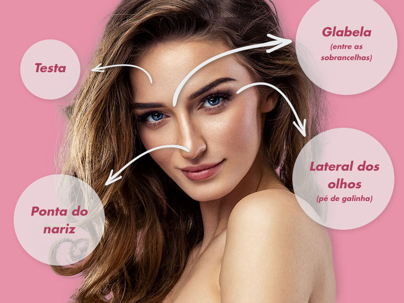 Imagem com fundo rosa e uma mulher em primeiro plano, estão destacadas todas áreas de aplicação de botox no rosto, que é a região da testa, glabela, lateral dos olhos e ponta do nariz