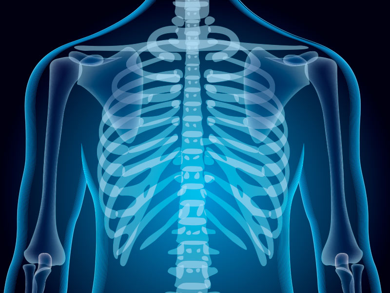 ilustração mostrando o raio-x e a função das costelas