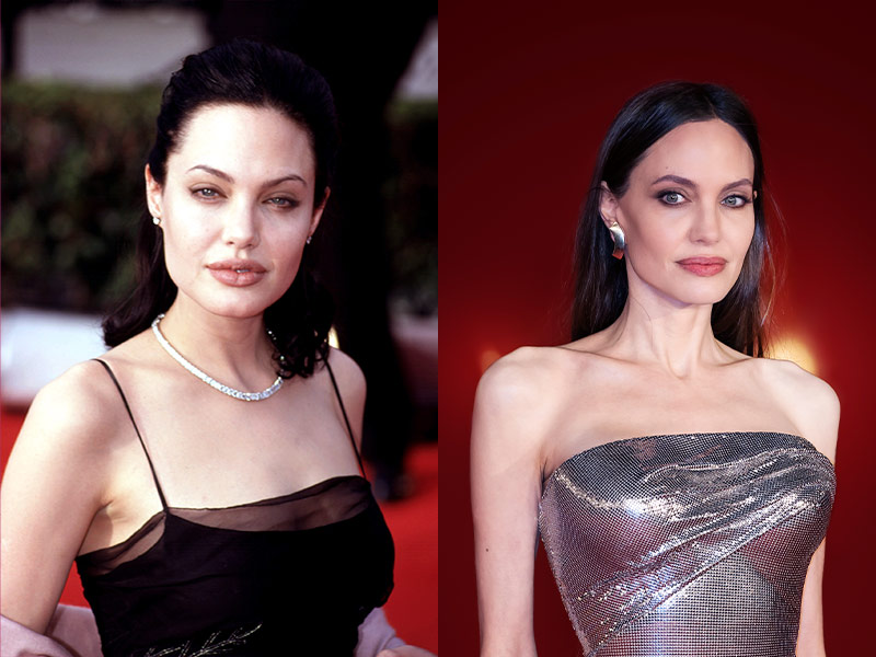 lifting antes depois angelina jolie