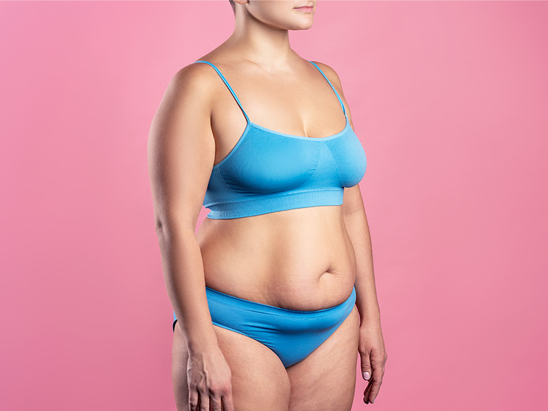 Para que serve a mastopexia? Mulher de calcinha e top azul, com o corpo na diagonal, que precisa fazer uma mastopexia redutora
