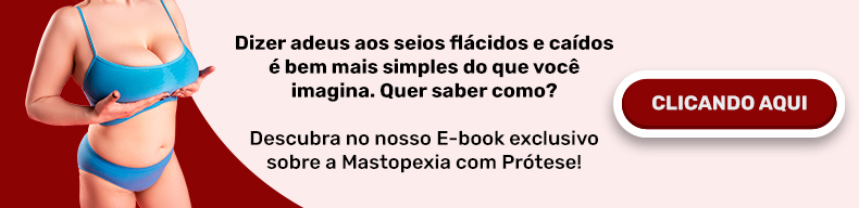 E-BOOK completo sobre mastopexia com prótese