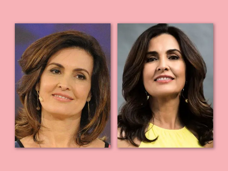 Imagem com o antes e depois da apresentadora Fátima Bernardes após aplicações de botox