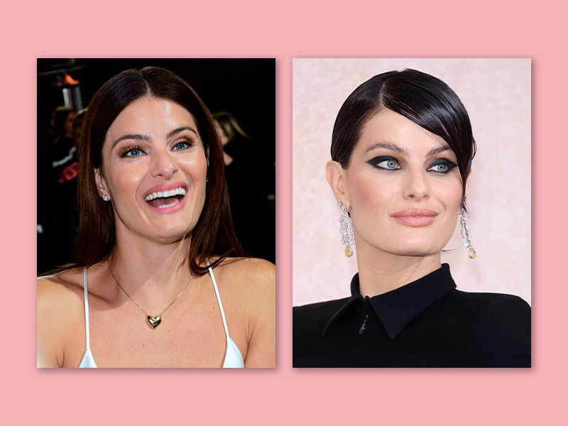 Imagem com o antes e depois da modelo Isabeli Fontana após aplicações de botox