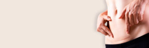 Cicatriz da Abdominoplastia