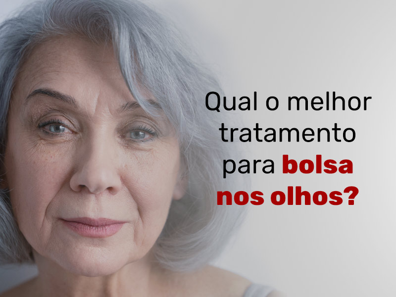 Imagem de uma mulher com bolsa nos olhos com os dizeres: qual o melhor tratamento para bolsa nos olhos