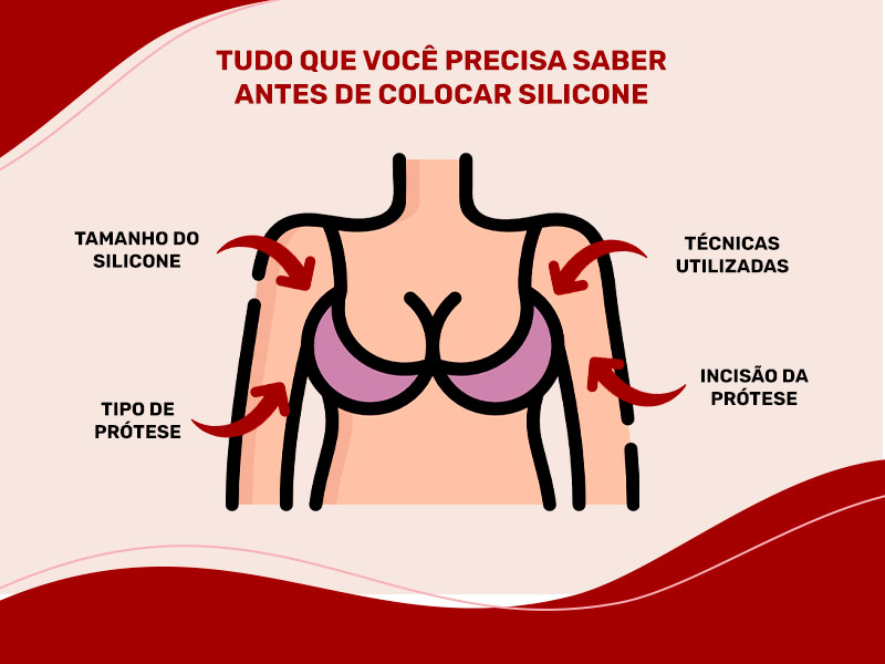 Ilustração mostrando tudo que precisa saber antes de colocar silicone, como o tamanho, tipo de prótese, incisão e técnica