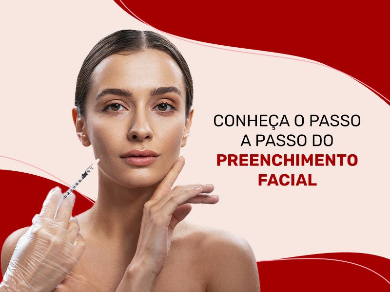 Imagem exemplificando como é feito o preenchimento facial. Na foto uma mulher aparecendo realizando o procedimento no rosto, com os seguintes dizeres: conheça o passo a passo do preenchimento facial