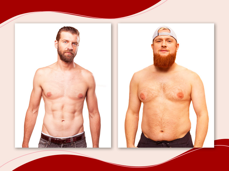 Duas imagens, uma de um homem magro, mais com seios maiores que o normal, e outra de um homem com gordura nos seios